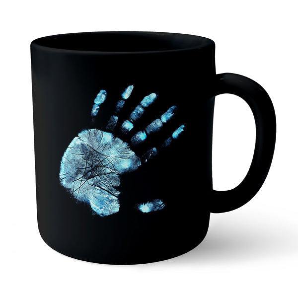 X-ray Hand Fingure Print - Black Ceramic Mug